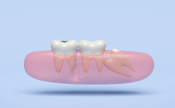 oral surgery